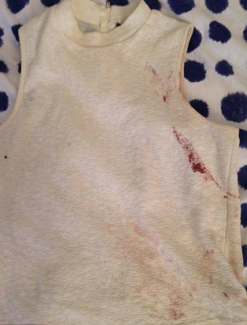 Isobel na Facebooku zveejnila fotografii krv upinnho trika, kter na sob...
