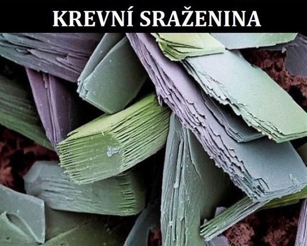 Krevn sraenina.