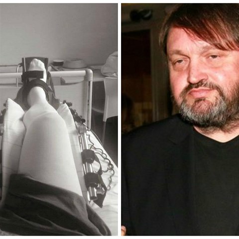 Josef Kokta si v nemocnici selfkoval operavanou nohu a vyjmenoval vechny...