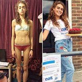 Margherita Barbieri (18) pemohla anorexii. Byly ale doby, kdy vila jen 25...