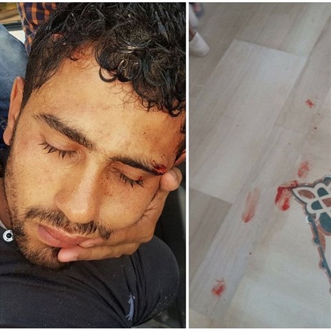 V egyptsk letovisku ubodal terorista dva lidi a zranil jednu eku