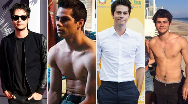 Dylan Obrien