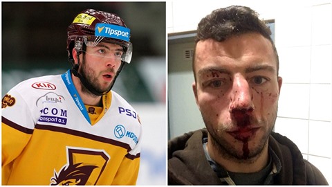 Jihlavský hokejista Michal Hlinka byl napaden skupinou nepizpsobivých...