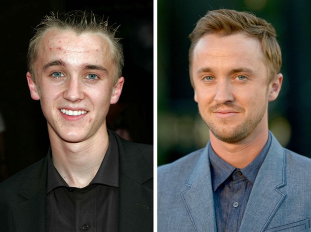 Tom Felton