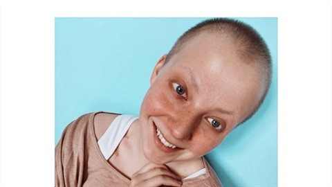 Anna Slováčková se raduje z centimetrového porostu na hlavě! Anna Slováčková se raduje z centimetrového porostu na hlavě!
