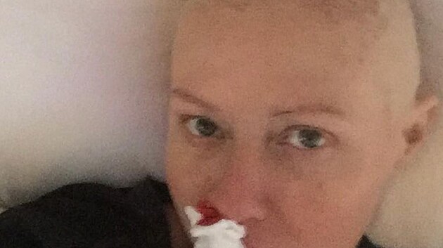 Shannen Doherty se podlila s fanouky o silný píbh ze svého boje z rakovinou.