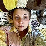 Anna Slovkov sdlela fotku po chemoterapii