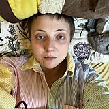Anna Slovkov sdlela fotku po chemoterapii
