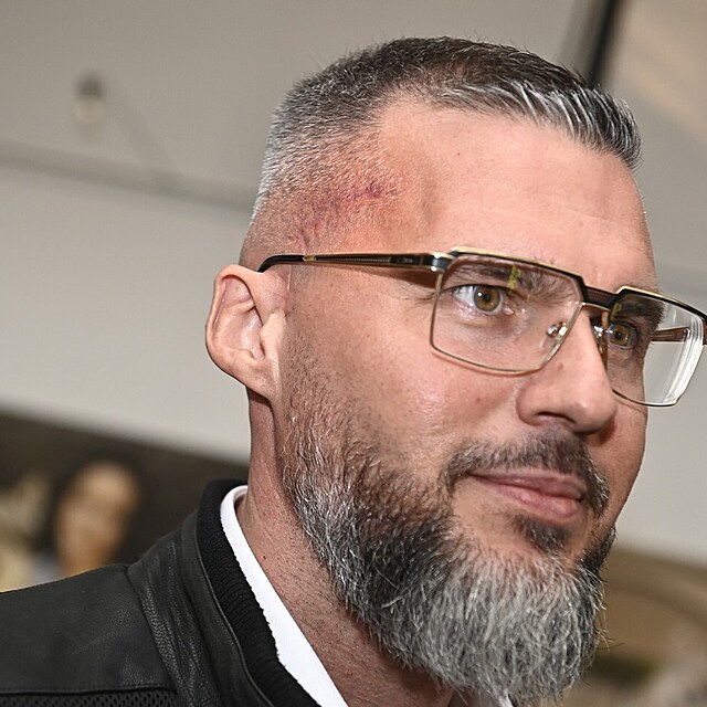 Radek Filipi se poprvé po operaci mozku objevil na veřejnosti.