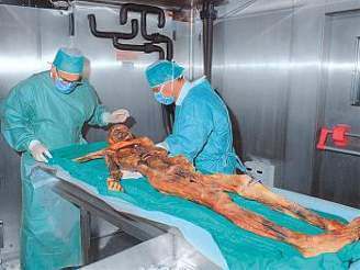 Ötzi