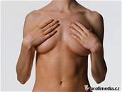Pnutí prsou je jedním z asných píznak thotenství.