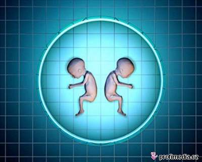 Vdci se uí vytváet náhradní buky a tkán pro ván nemocné. Pi klonování vak vyuívají, nebo dokonce vytváejí embrya. Bude s tím veejnost souhlasit?