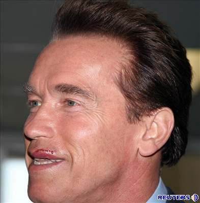 Arnolda Schwarzeneggera zdobí po nehod 15 steh.