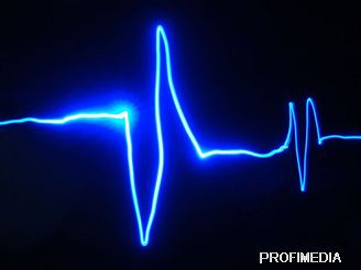 Kardiogram, tep srdce