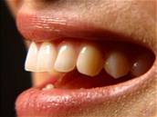 K tmavnutí zub dochází i vlivem vku a mohou se na nich objevit i skvrnky.