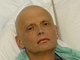 Alexander Litvinnko v londnsk nemocnici