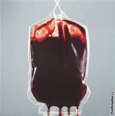 Problémy s transfuzí by mohla vyeit univerzální krev.