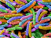Bakterie dostala jméno Candidatus Chloracidobacterium thermophilum. Ilustraní foto