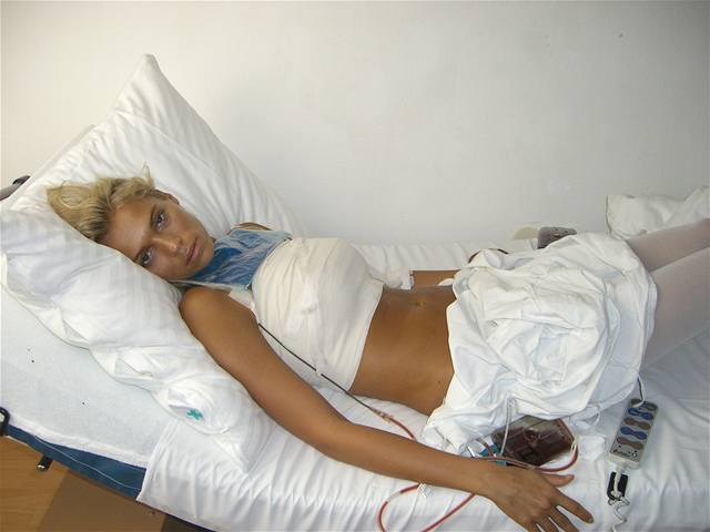 Hana Malíková po plastické operaci prsou 