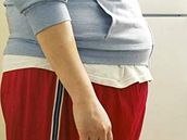 Cukrovka asto souvisí s obezitou. Ilustraní foto.