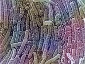 Bakterie C. difficile u zabíjela v Kanad, USA a Británii.