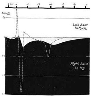 Prvn ECG