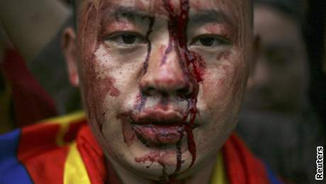Krev na tvái tibetského mnicha. Po zákroku policie v Káthmándú, Nepál, 17. bezna 2008.