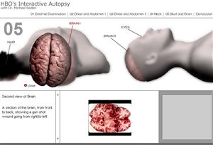 virtuln pitva na HBO: Virtual Autopsy