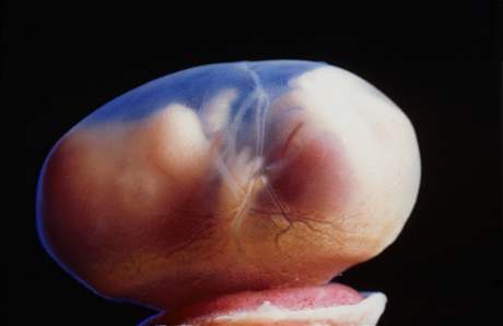 Pi preimplantaní diagnostice se vyrábí embryo, v podstat lidská bytost, jen na zkouku.