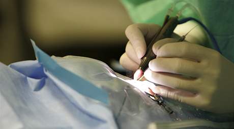 Operace edého zákalu na klinice NeoVize v Brn