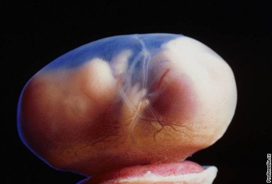 Pi preimplantaní diagnostice se vyrábí embryo, v podstat lidská bytost, jen na zkouku.