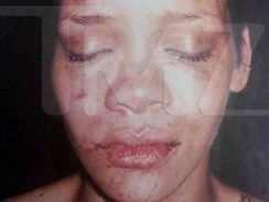 Zmlcen Rihanna - fotografii zveejnil portl TMZ.com