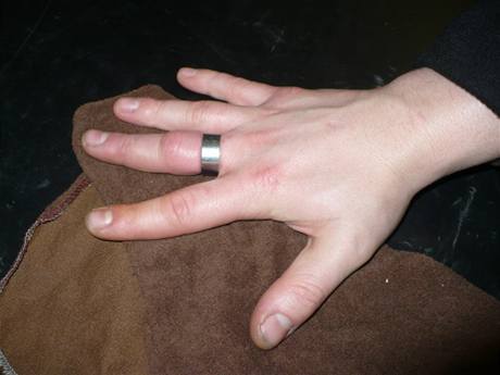 Zchrana mue, jeho prst sevel prstnek z chirurgick oceli 
