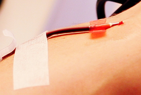 Transfuze krve