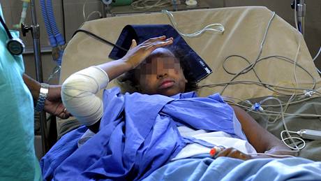 trnáctiletá Bahia Bakari v péi léka nemocnice v Moroni