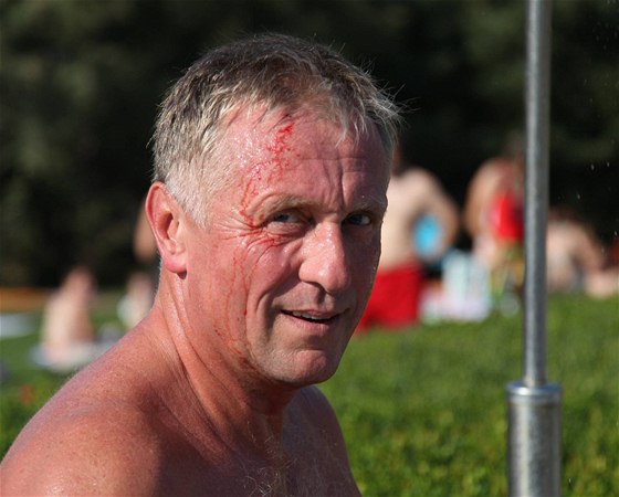Mirka Topolánka napadli na koupaliti v Hustopeích tyi mui. Kamenem ho 21. srpna 2009 zranili na hlav.