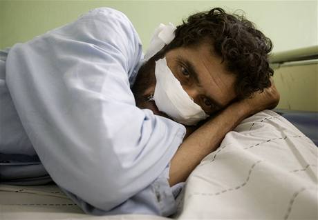 Lla Mohameda znetvoili Talibanci, te se l v kbulsk nemocnici (31. srpna 2009)