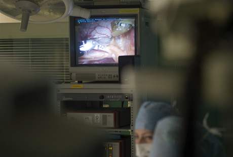 Operace srdce (ilustraní foto)