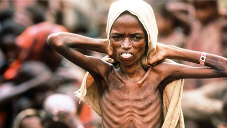 Chlapec v hladomorem postieném Somálsku. Ilustraní foto