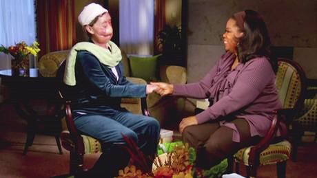 Charla Nashov odhalila v The Oprah Winfrey Show svj znetvoen obliej