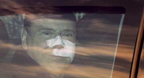 Silvio Berlusconi opoutí milánskou nemocnici (17. prosinec 2009)