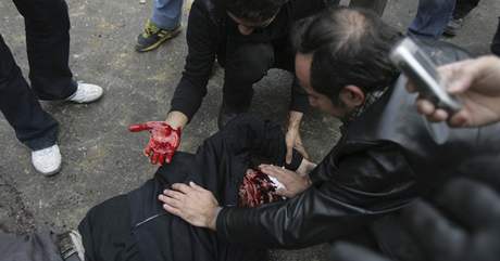 Jeden ze zranných pi demonstracích v Íránu 27. prosince