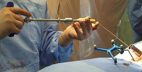 Chirurg pipravuje implantt