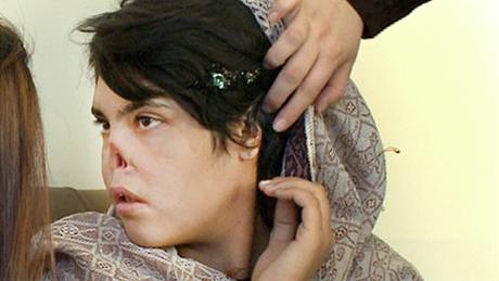 Devatenáctileté Bibi Aishaové z afghánistánu uízl ui a nos manel.