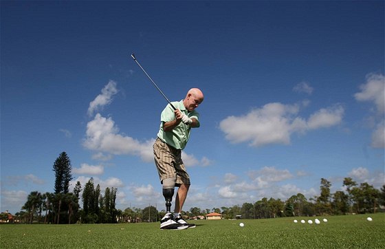 Ken Green na golfu po amputaci pravé nohy v podkolení.