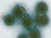 Oživená buňka JCVI-syn1 se syntetickým DNA. Oživená buňka JCVI-syn1 se syntetickým DNA.