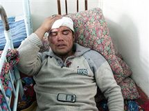 Zrann etnit Uzbek v nemocnici u msta O na jihu Kyrgyzstnu (12. ervna 2010)