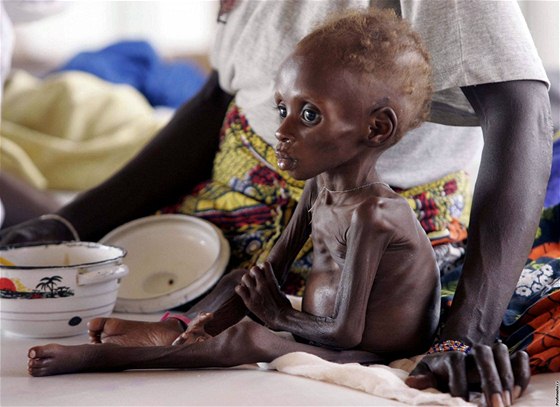 Malý chlapeek z Nigeru bhem hladomoru v roce 2005
