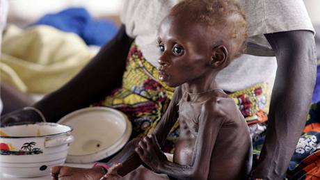 Malý chlapeek z Nigeru bhem hladomoru v roce 2005