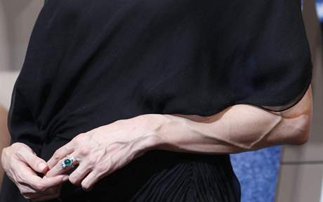 Angelina Jolie ukzala vystoupl ly na rukou